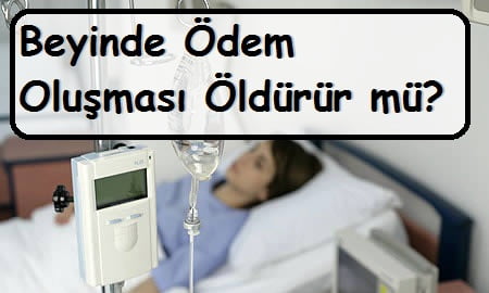 Beyinde Ödem Oluşması Öldürür mü