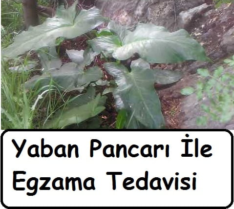 Yaban Pancarı İle Egzama Tedavisi