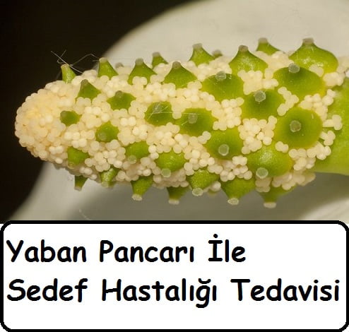 Yaban Pancarı İle Sedef Hastalığı Tedavisi